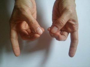 fáj a jobb kéz középső ujjának középső ízülete